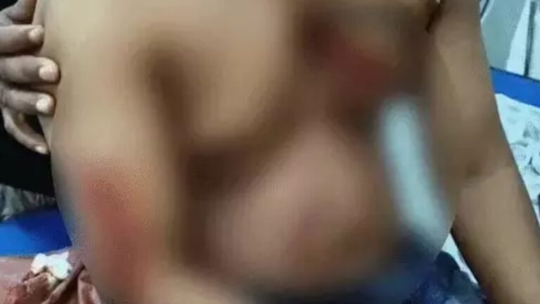 गणेश विसर्जन के दौरान खूनी विवाद, तीन युवकों पर चाकू से हमला; जूना बिलासपुर में भी मारपीट से मचा हंगामा